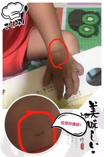 宝宝总是有咬人的习惯怎么办,宝宝喜欢咬人该怎么纠正