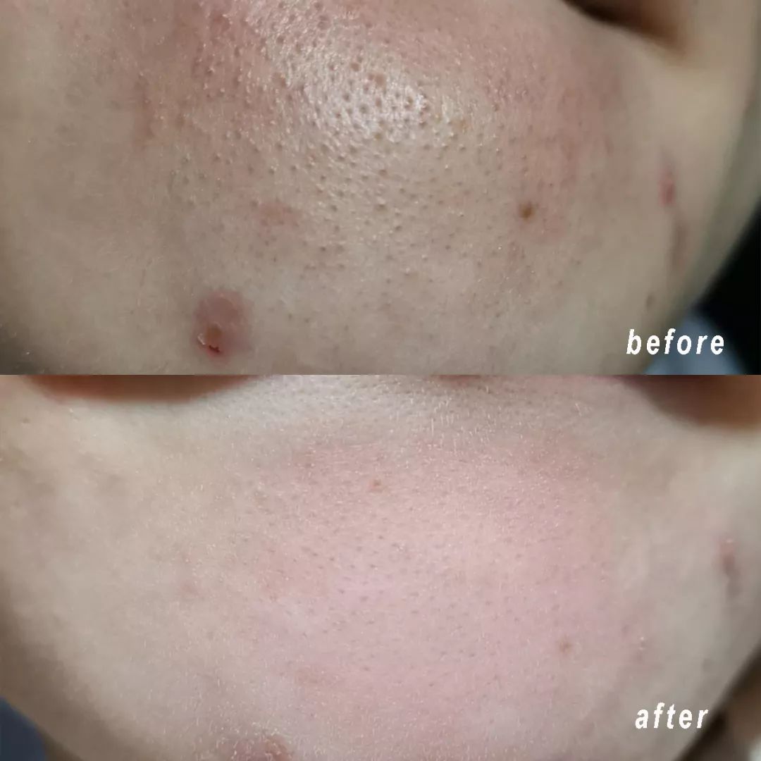 清洁面膜测评踩雷,清洁面膜测评排行榜前十位