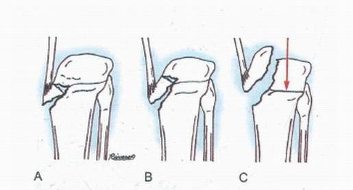 想当中医看骨科应学什么专业,骨科专业知识有哪些