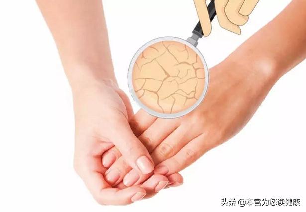 手严重脱皮一年四季怎么快速解决,如果手总是脱皮怎么办