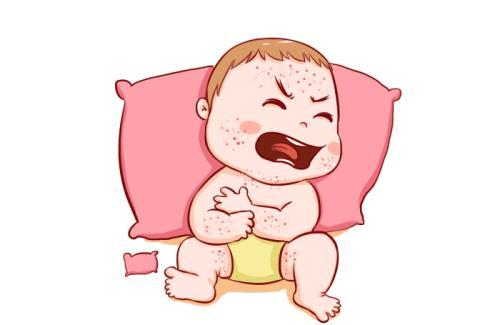宝宝麻疹来袭，妈妈们别着急，几个护理的小方法让孩子远离侵袭！