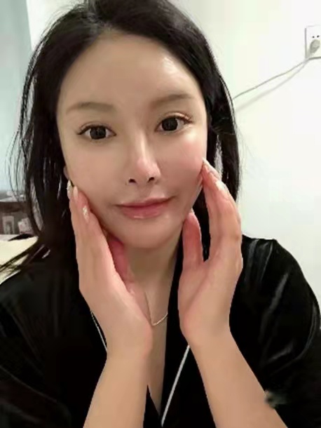 热门洗面奶会烂脸吗,cpb洗面奶和资生堂洗面奶哪个好用