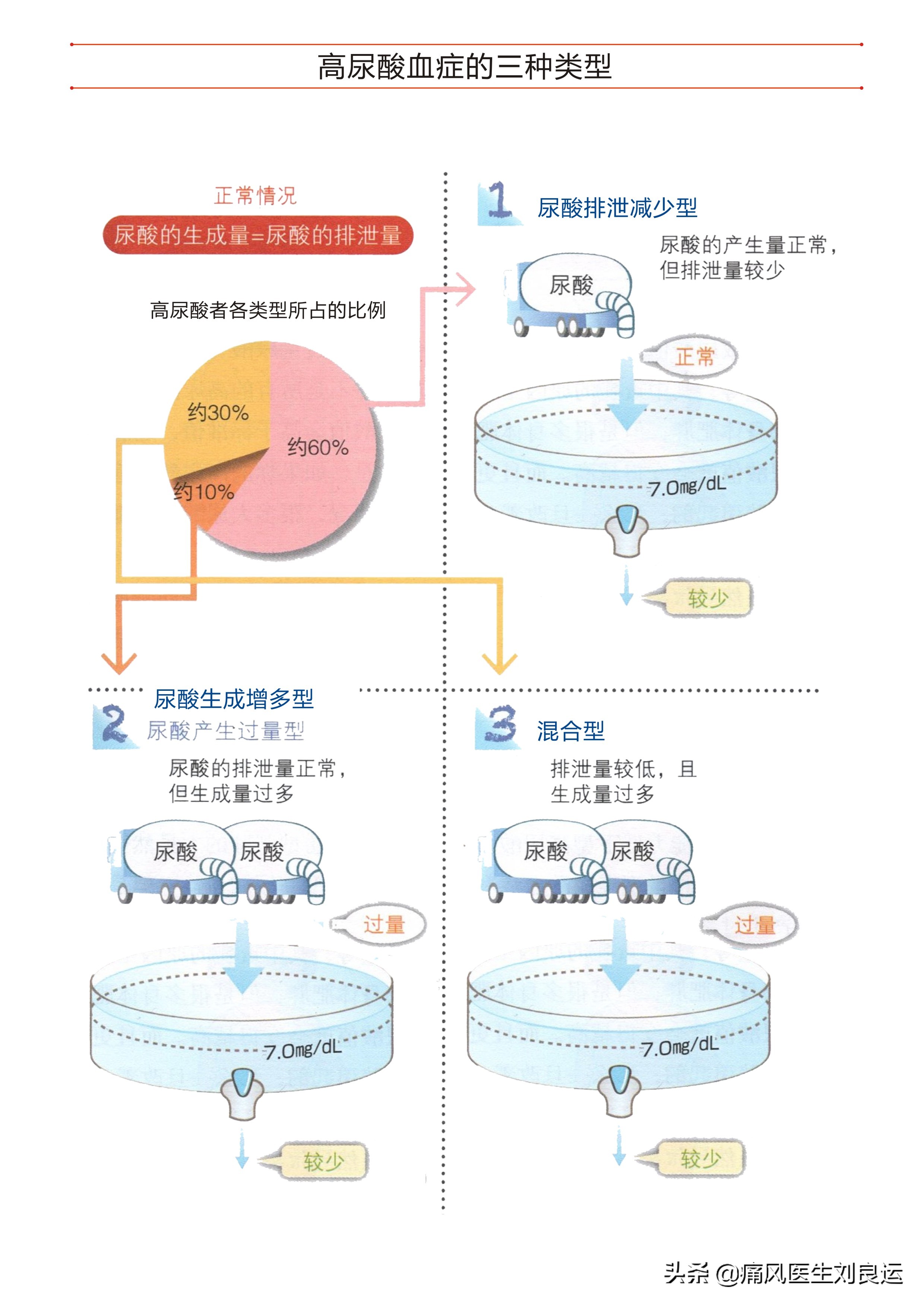 非布司他可以治痛风,痛风患者也不能随便自行用药降尿酸