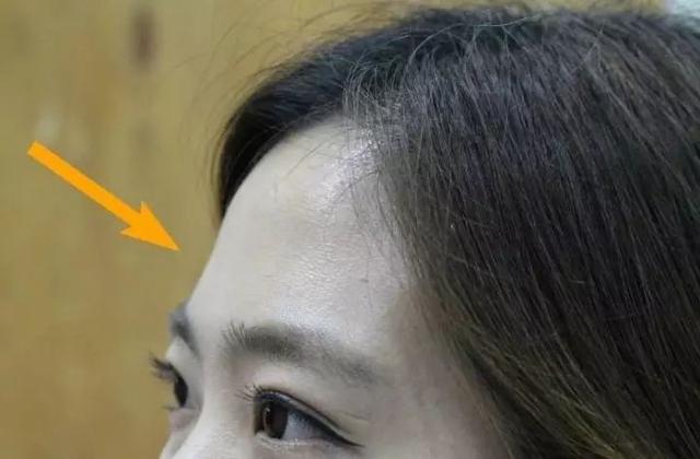 哪种额头不适合露出来,脸窄适合露额头
