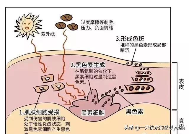 网红美白精华改善暗沉,平价美白精华见效快