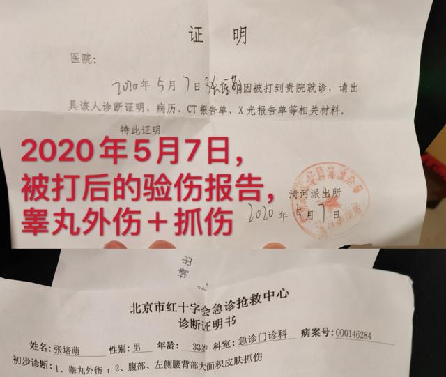 张培萌100米跑赢苏炳添,张培萌飞人事件