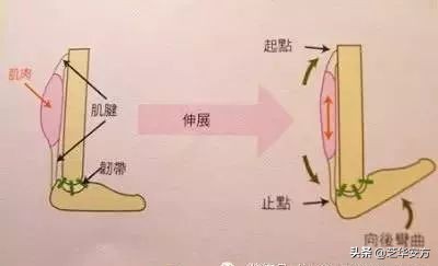 推荐三个步骤改善足底筋膜炎,泡脚能改善足底筋膜炎吗