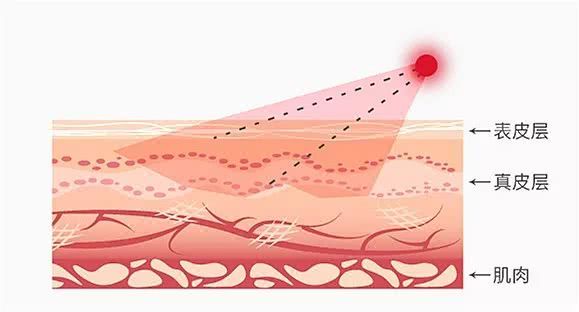射频美容仪哪个牌子最好用,amiro射频美容仪测评