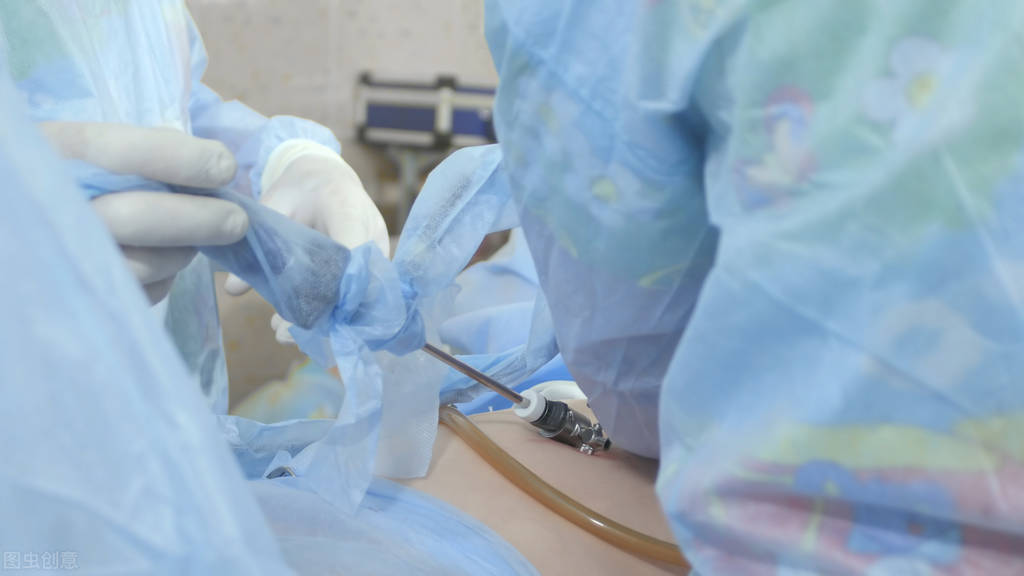 上海看腹膜后肿瘤最厉害医生,上海治疗腹膜后肿瘤