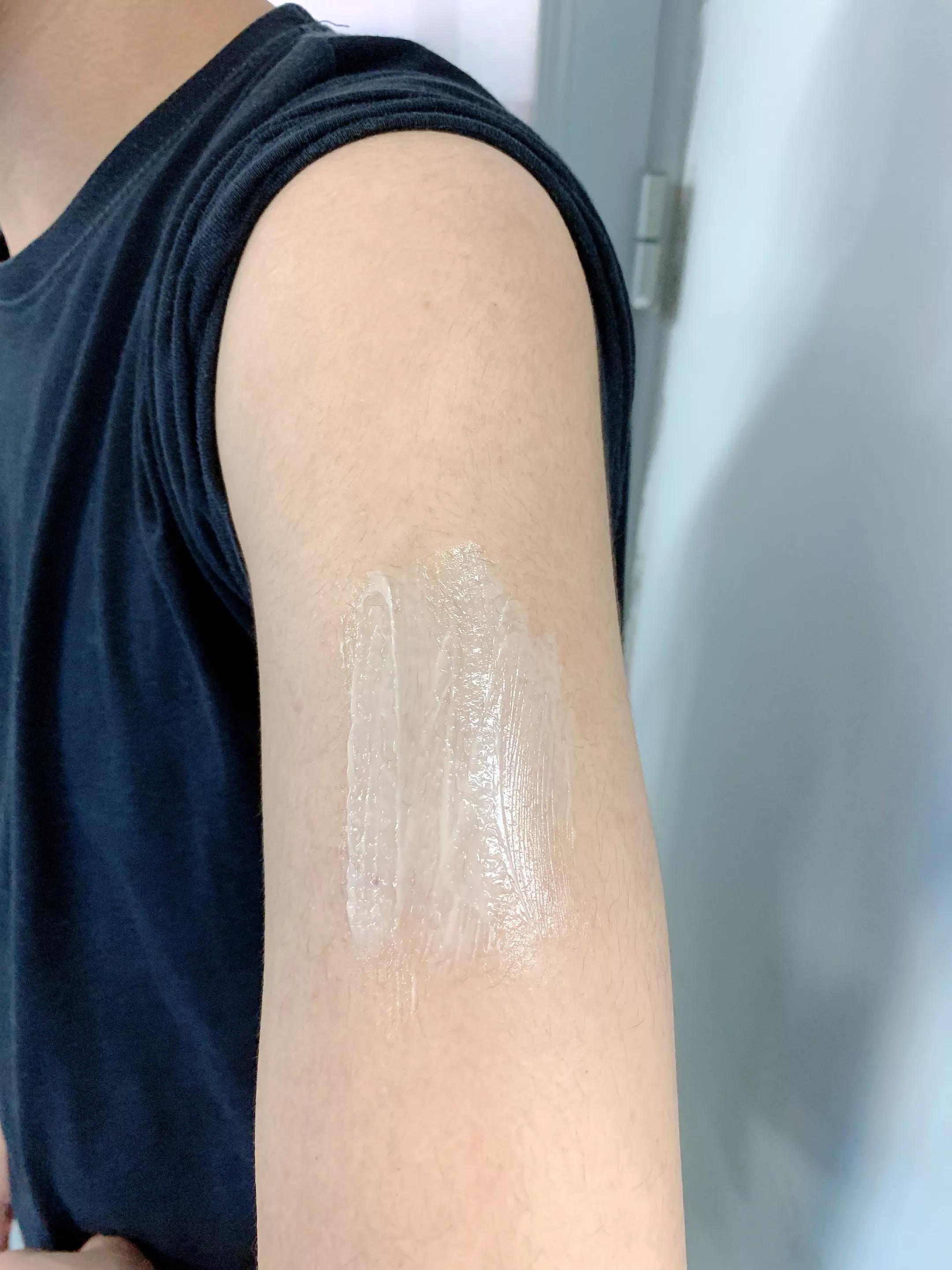 男朋友手臂上长很多小痘痘,男朋友手臂很多痘痘