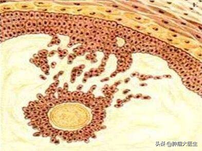 肿瘤标志物检测的常见问题,6种肿瘤标志物