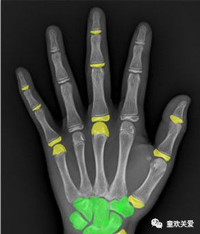 收藏未来价值,收藏未来