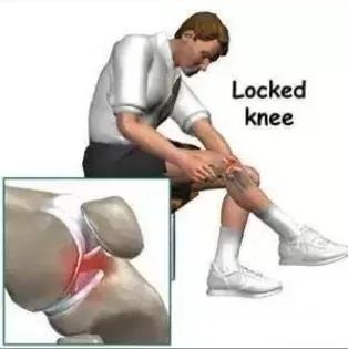 微创手术能治好骨性关节炎吗,膝盖关节镜微创手术要脱衣服吗