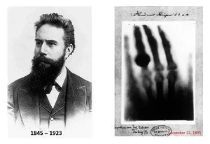 放射治疗什么意思,放射治疗是什么手段