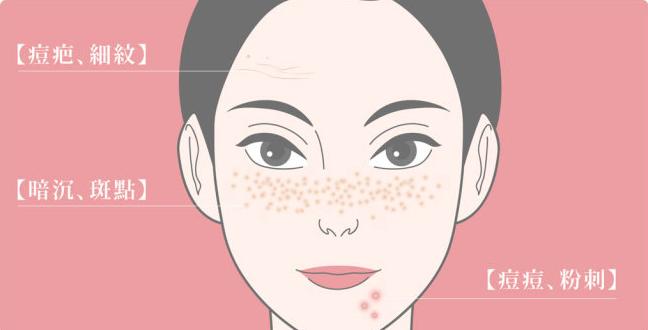 刷酸到底好不好,美容刷酸的副作用是什么