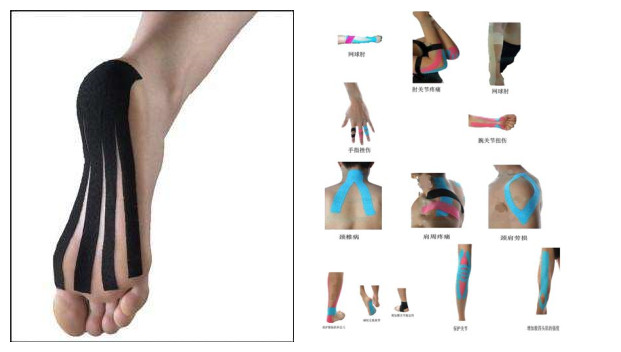 骨刺与跖筋膜炎怎么治疗,足跟痛骨刺与跖筋膜炎