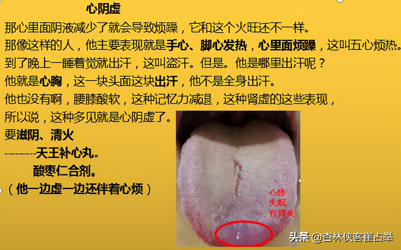 治疗失眠什么中成药效果好,治疗失眠中成药大总结