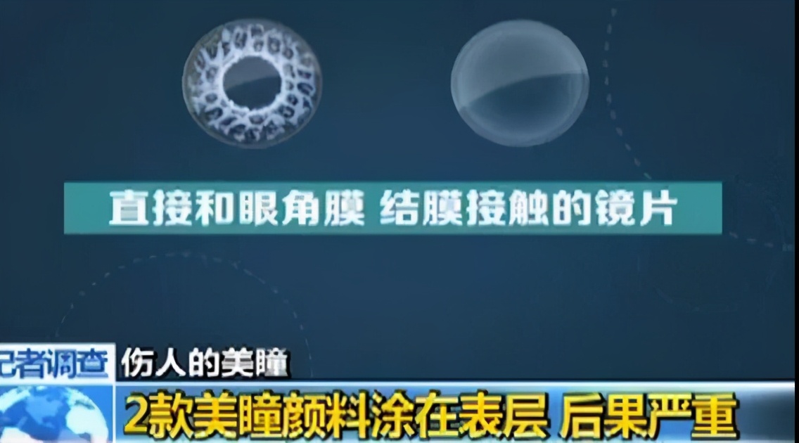 儿童角膜溃疡严重会穿孔吗,儿童角膜溃疡