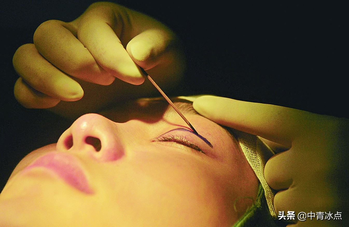 整容失败后维权有多难：有人整容后删掉所有以前照片无法固定证据，有人疤痕不足6厘米无法做司法鉴定