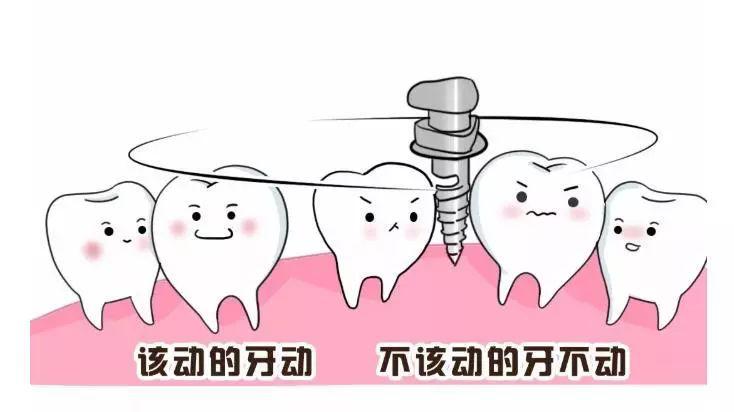 大连齿医生口腔补牙洞视频,口腔正畸打骨钉动画演示