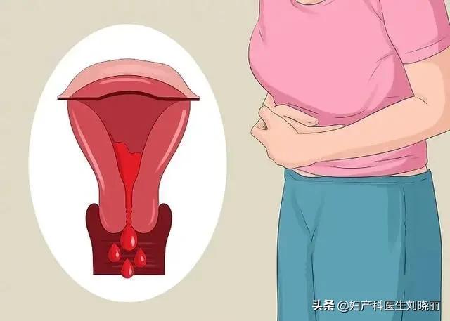 你的“大姨妈”是什么颜色的？