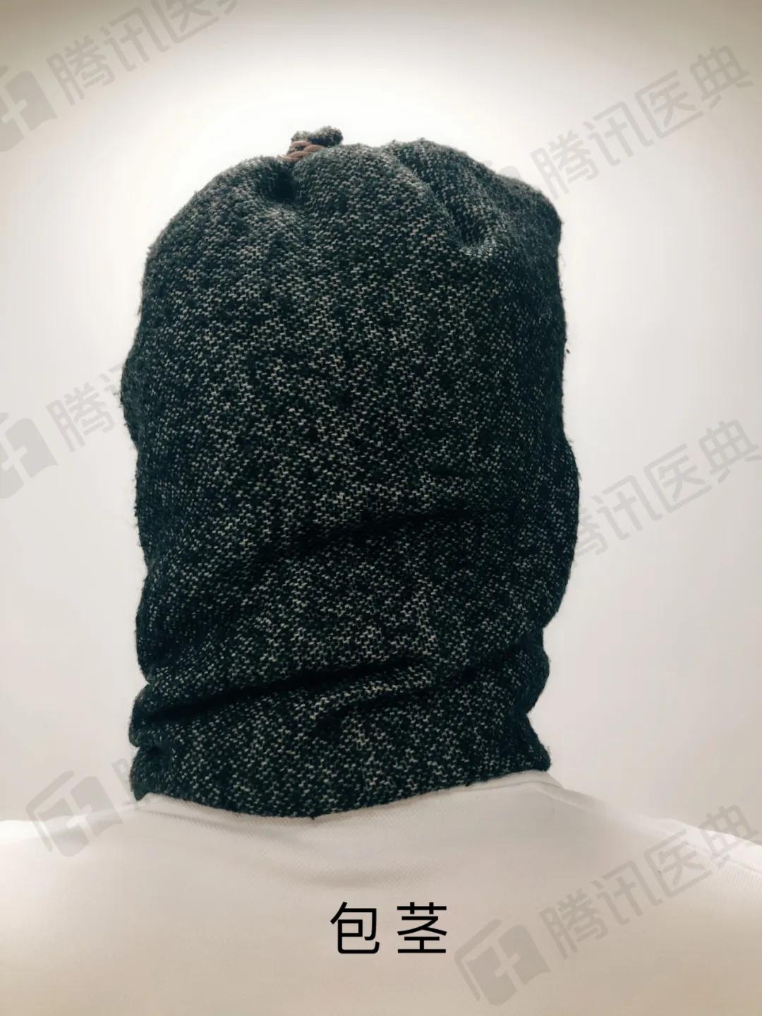 割包皮能解决系带短吗,割包皮能不能解决包皮嵌顿问题