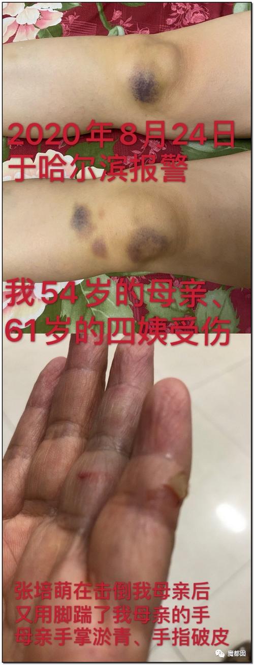 短跑名将张培萌家暴事件,短跑名将张培萌殴打岳母视频