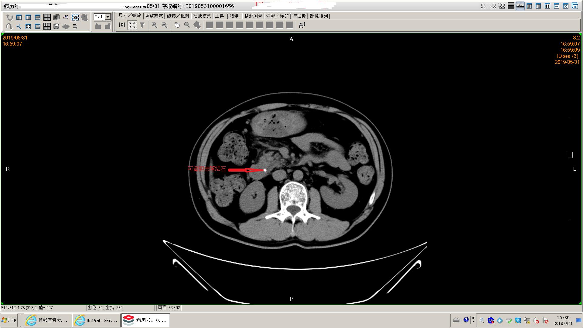 狗得了胰腺炎怎么办,狗得了胰腺炎治疗