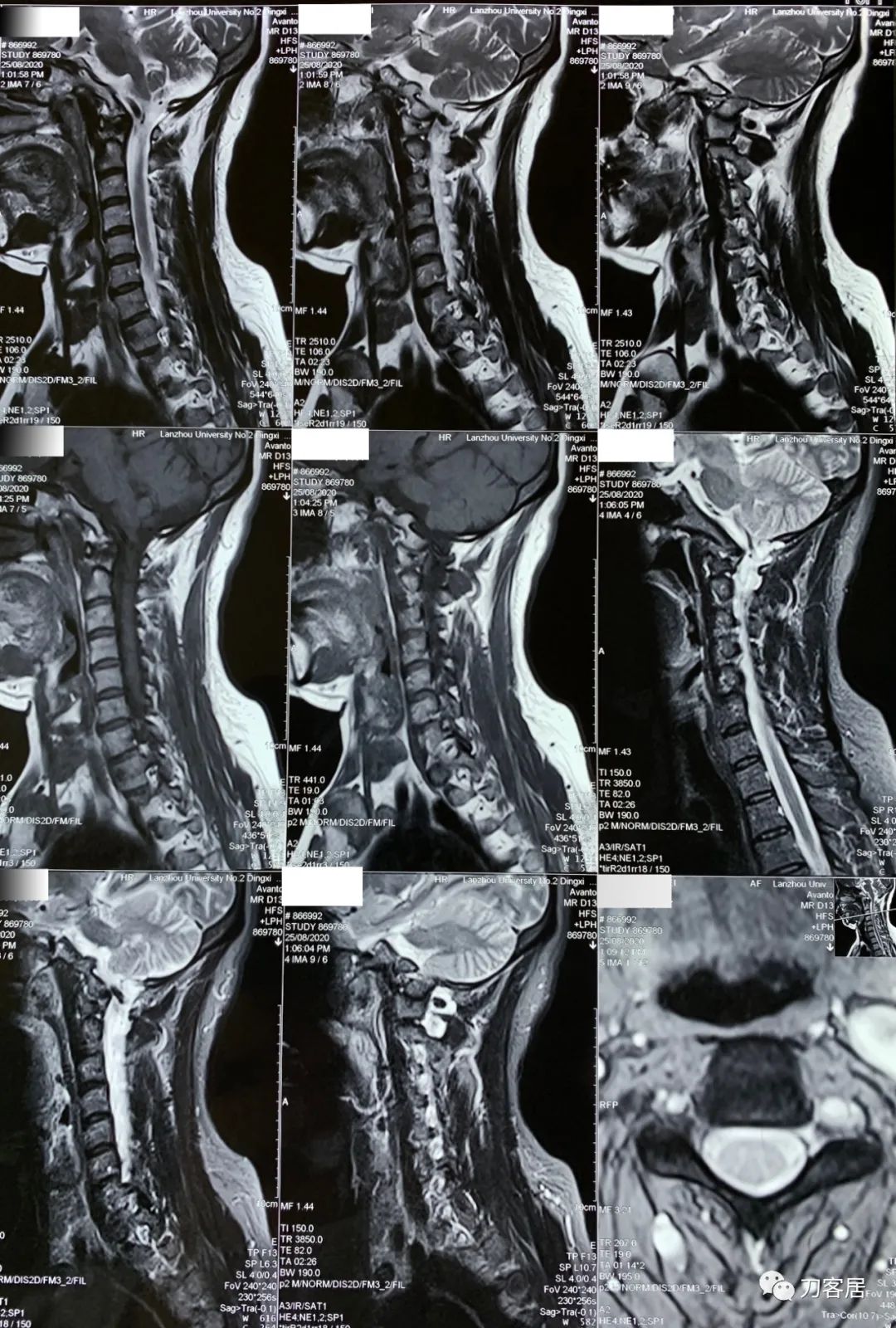 我的门诊病历,我的门诊
