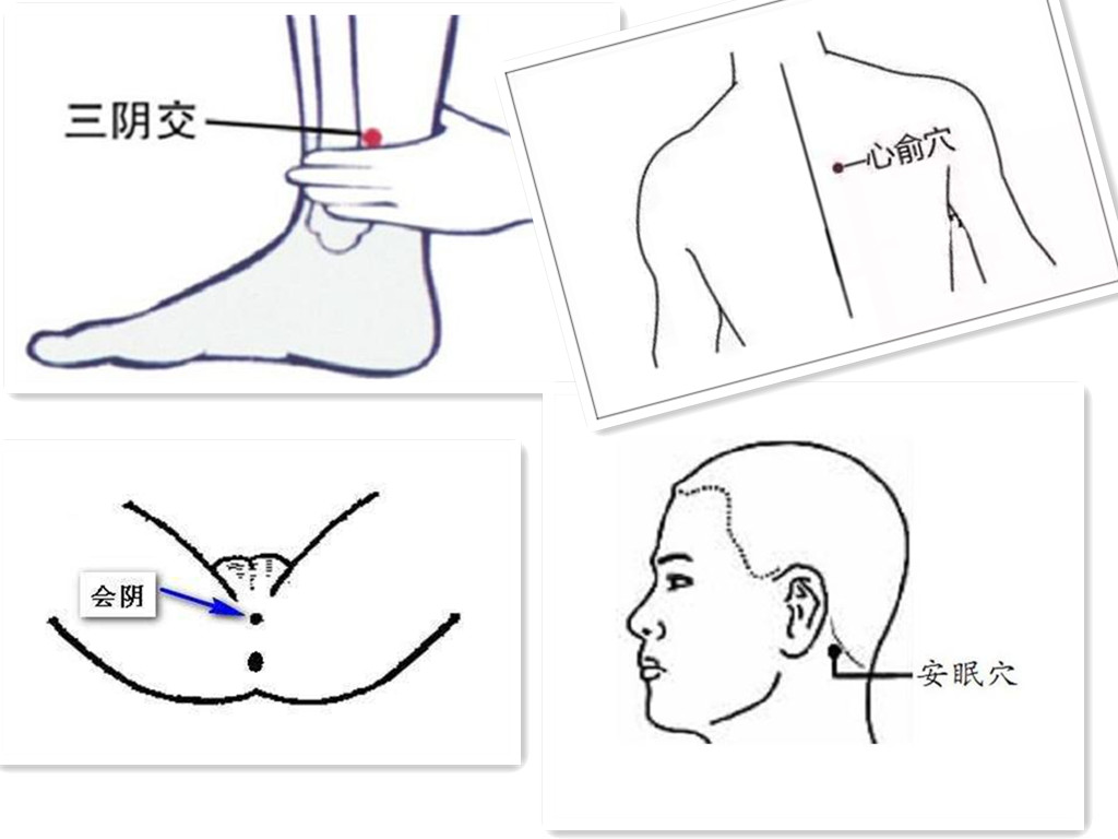 我的天呀！得了神经衰弱，这里有治疗方法哟——宏世堂干货分享