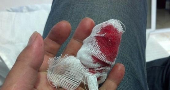 摩托链条清洗,摩托车清洗链条的正确步骤