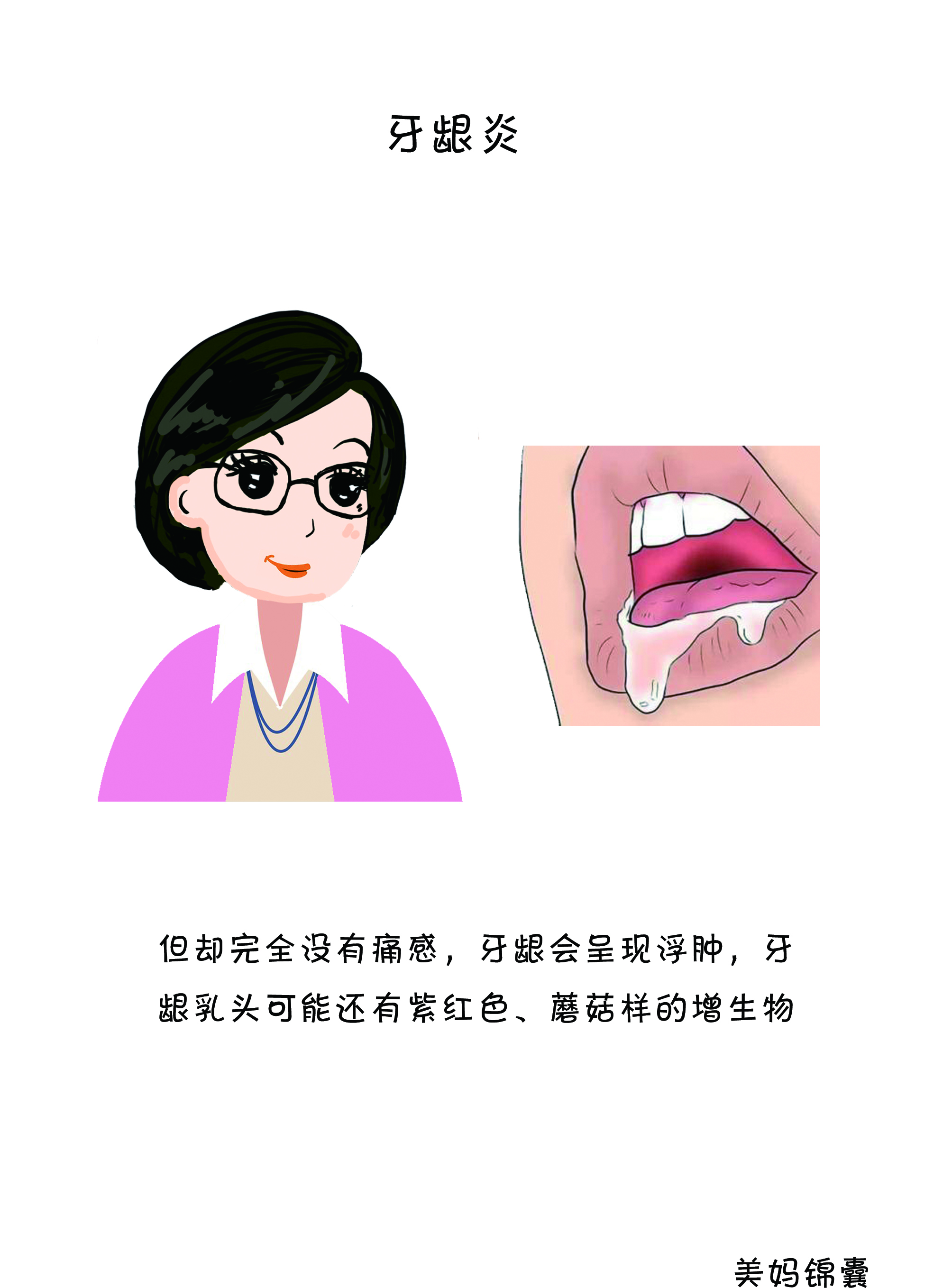 孕期牙龈炎严重怎么办,孕期牙龈炎老出血