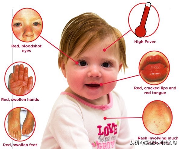 白细胞高c反应蛋白高是什么感染,白细胞偏高细菌感染引发的发烧