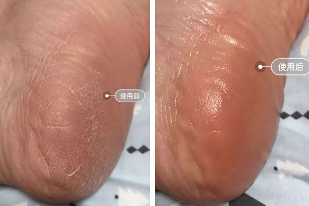 蔡依林的腿值多少钱,蔡依林最迷人的鞋