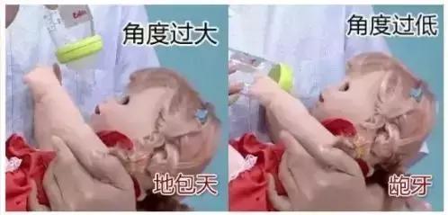 长期使用奶瓶引起的嘴唇外翻图片,奶瓶用久了会龅牙吗