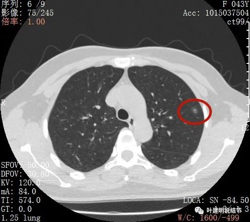 从活检怎么看是非小细胞癌,从病例谈辨证论治