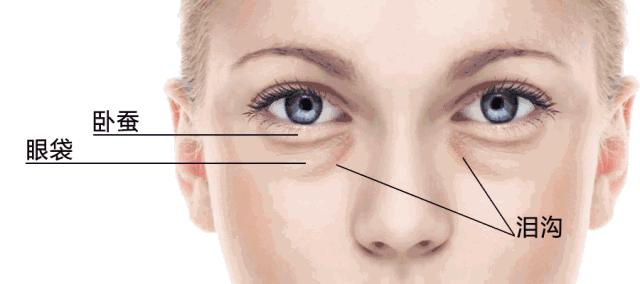 眼袋眼纹黑眼圈改善方法,去黑眼圈眼袋眼纹最有效的小妙招