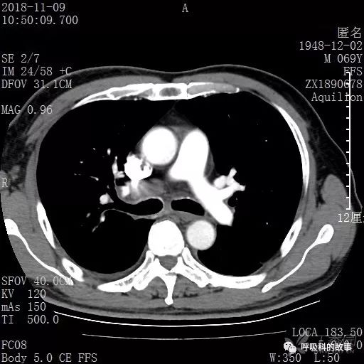 怎么应用统计学做调查,统计学方法可以解决的主要问题