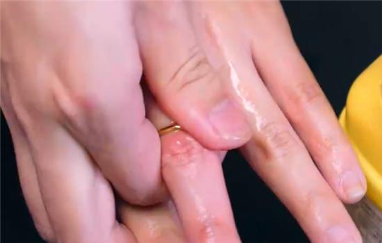 戒指戴太久取不出来怎么办,戒指太紧取不下来的最佳方法