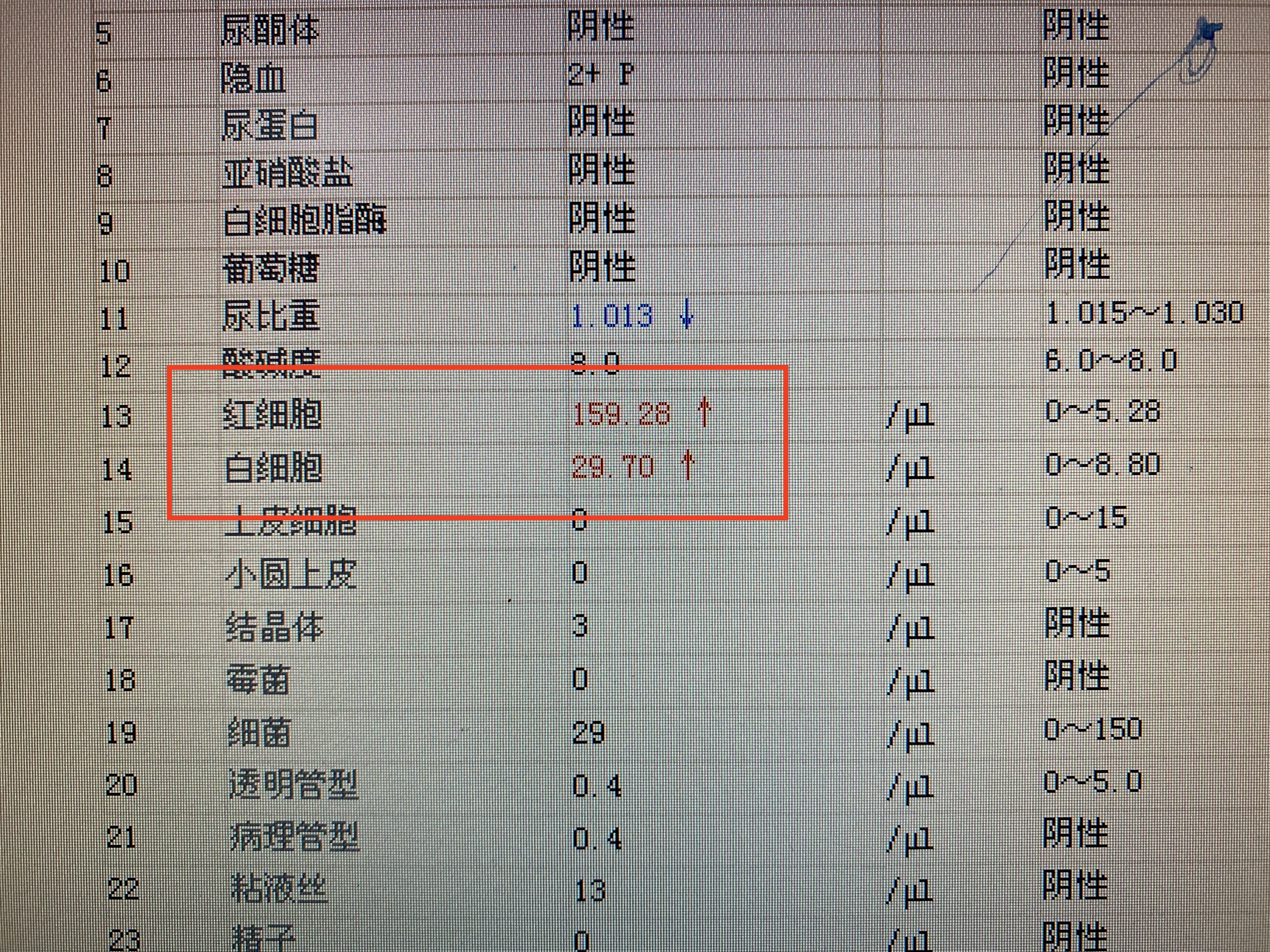 医院泌尿外科都看些什么病,哪些病需要去看泌尿外科