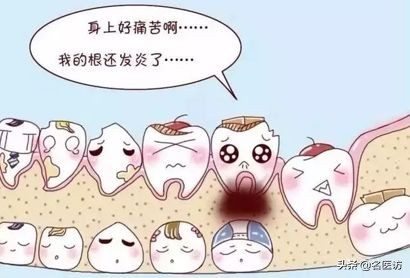 疫情期间牙痛怎么快速止疼,牙痛不是大病但痛起来要命