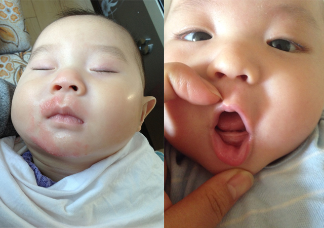 宝宝长牙齿流口水怎么办,宝宝牙齿流口水过敏怎么办