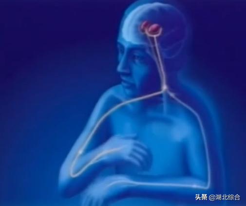 治疗帕金森有新方法及新药吗,科学治疗帕金森让你从此不怕