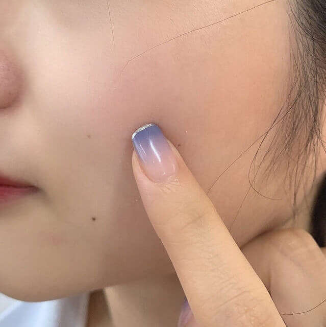 混合性皮肤护肤品10强,选择前先来了解下肌肤类型