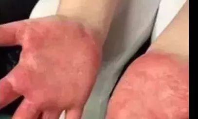 「德州提醒」这些含毒硼砂的致命玩具，赶快让孩子远离