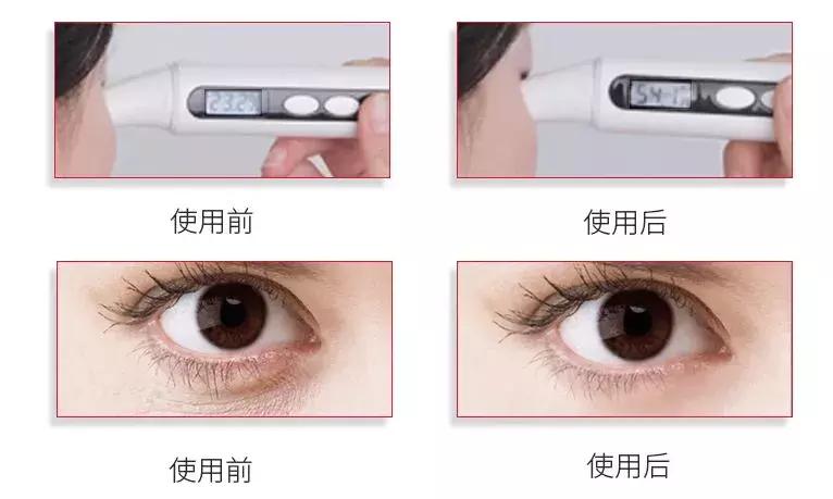 眼部护理大揭秘改善眼纹,眼部眼纹保养