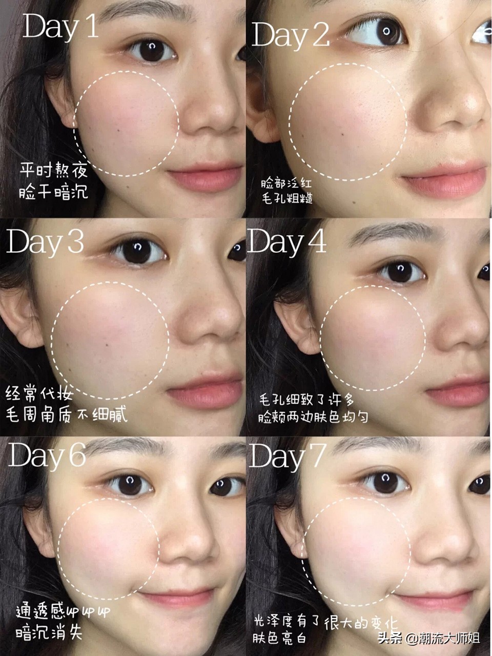 怎样才可以彻底告别痘痘肌,三招教你告别痘痘肌的烦恼