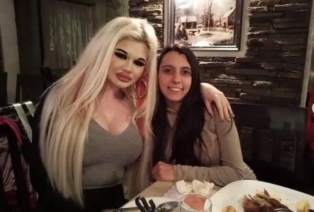 世界上最厚的嘴唇,世界上嘴唇最厚的人是谁