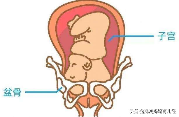 胎儿已经入盆了怎么迟迟不发动,胎儿入盆的表现和症状有哪些