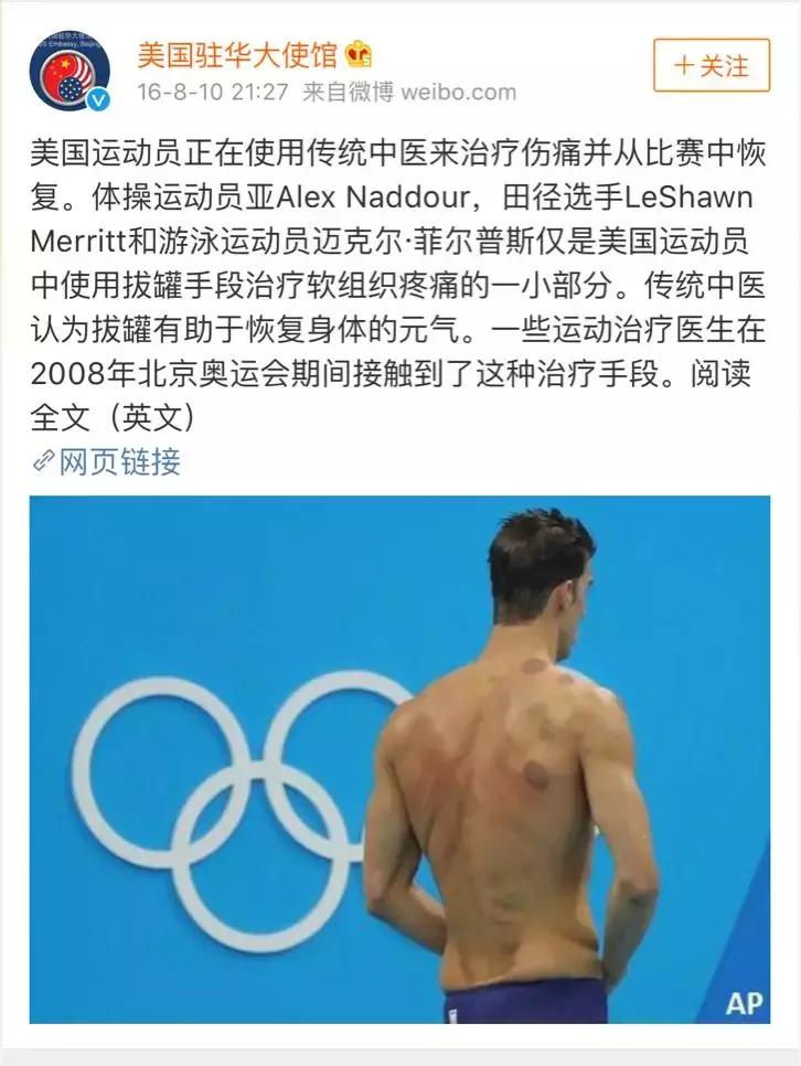 老外有多迷恋拔火罐,外国人吐槽中国拔罐